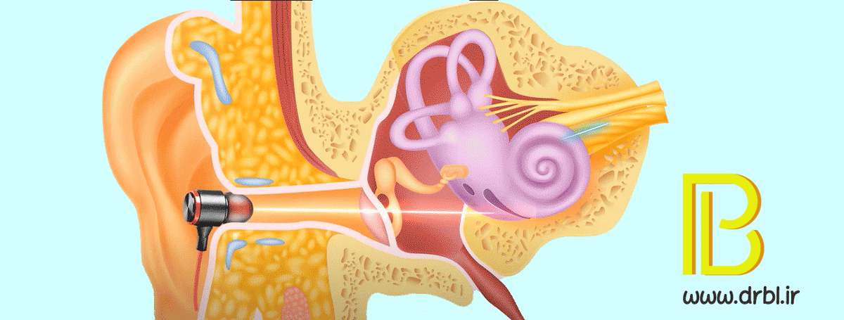 درمان وزوز گوش با لیزر